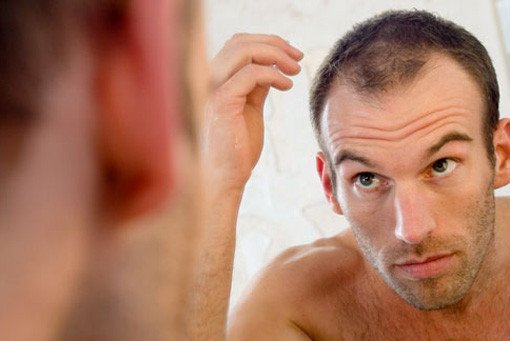 hairstyle tips for guys with thinning hair